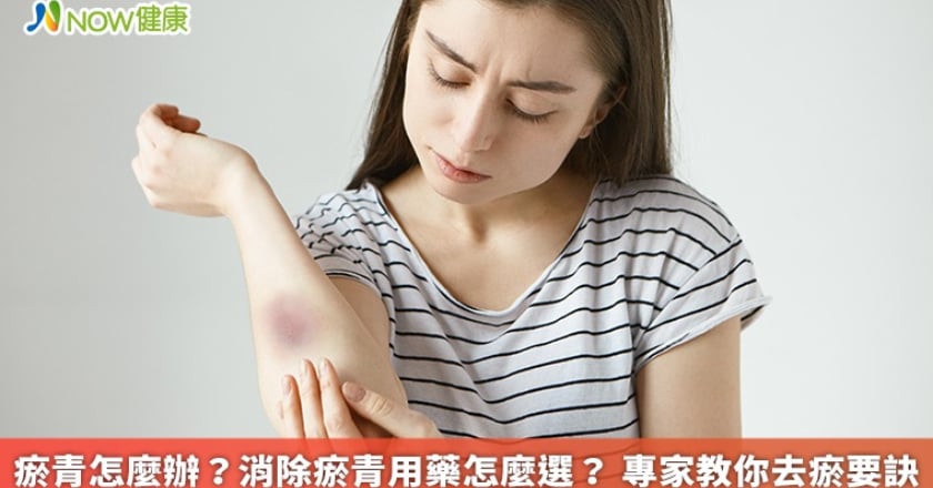 瘀青怎麼辦？消除瘀青用藥怎麼選？ 專家教你去瘀要訣