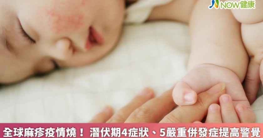 全球麻疹疫情燒! 潛伏期4症狀、5嚴重併發症提高警覺