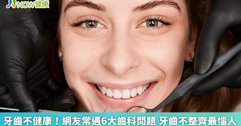 牙齒不健康!網友常遇6大齒科問題 牙齒不整齊最惱人