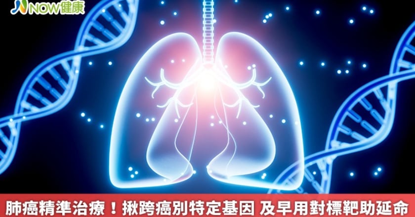 肺癌精準治療！揪跨癌別特定基因 及早用對標靶助延命