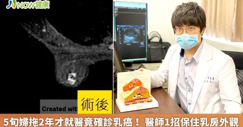 5旬婦拖2年才就醫竟確診乳癌！ 醫師1招保住乳房外觀