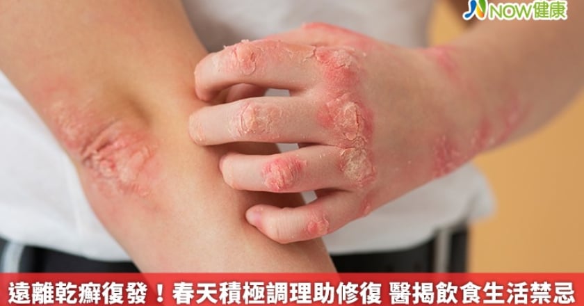 遠離乾癬復發！春天積極調理助修復 醫揭飲食生活禁忌