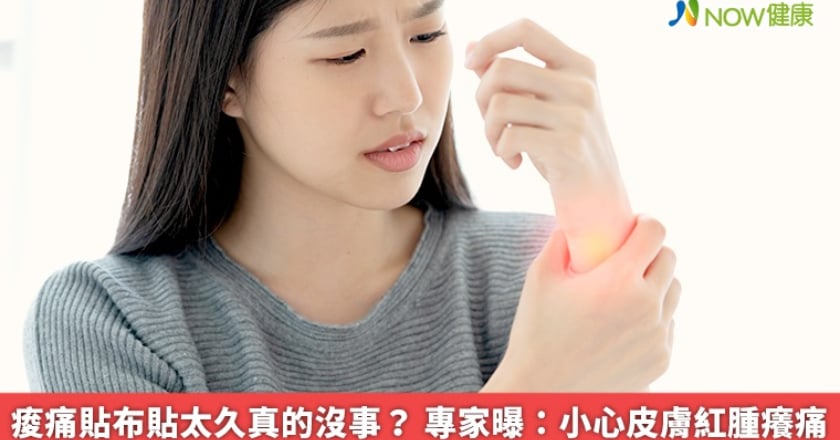 痠痛貼布貼太久真的沒事？ 專家曝：小心皮膚紅腫癢痛