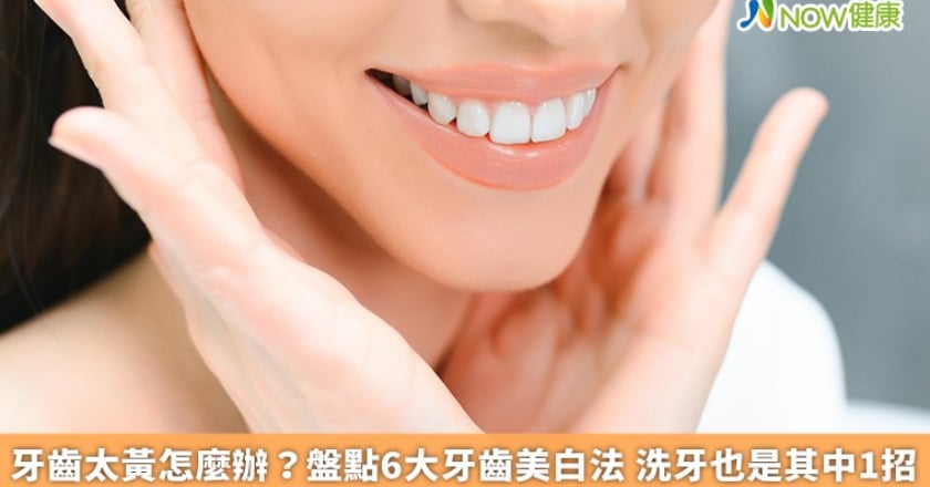 牙齒太黃怎麼辦？盤點6大牙齒美白法 洗牙也是其中1招