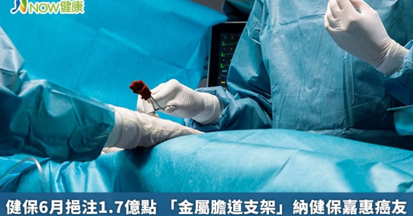 健保6月挹注1.7億點 「金屬膽道支架」納健保嘉惠癌友