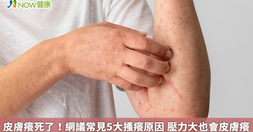 皮膚癢死了!網議常見5大搔癢原因 壓力大也會皮膚癢