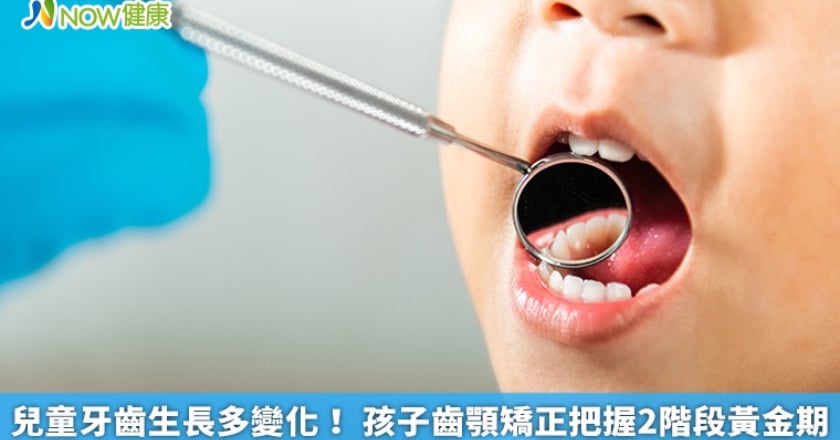兒童牙齒生長多變化！ 孩子齒顎矯正把握2階段黃金期