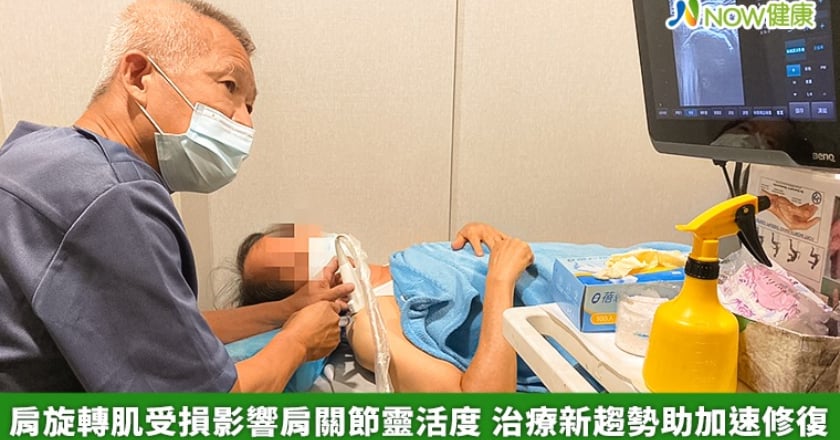 肩旋轉肌受損影響肩關節靈活度 治療新趨勢助加速修復