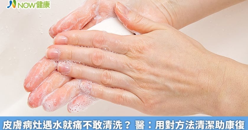 皮膚病灶遇水就痛不敢清洗？ 醫：用對方法清潔助康復