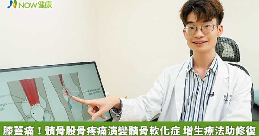 膝蓋痛！髕骨股骨疼痛演變髕骨軟化症 增生療法助修復