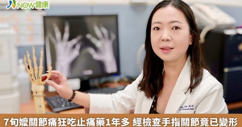 7旬嬤關節痛狂吃止痛藥1年多 經檢查手指關節竟已變形