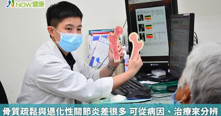 骨質疏鬆與退化性關節炎差很多 可從病因、治療來分辨