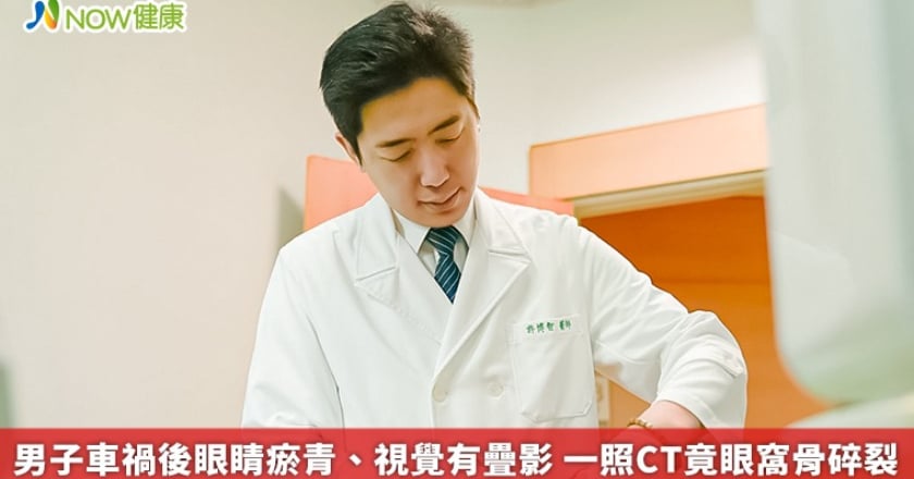 男子車禍後眼睛瘀青、視覺有疊影 一照CT竟眼窩骨碎裂