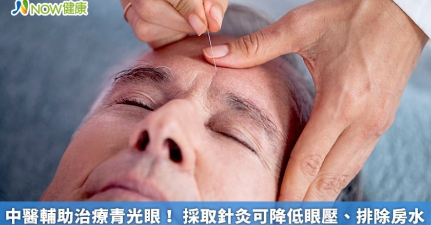 中醫輔助治療青光眼！ 採取針灸可降低眼壓、排除房水