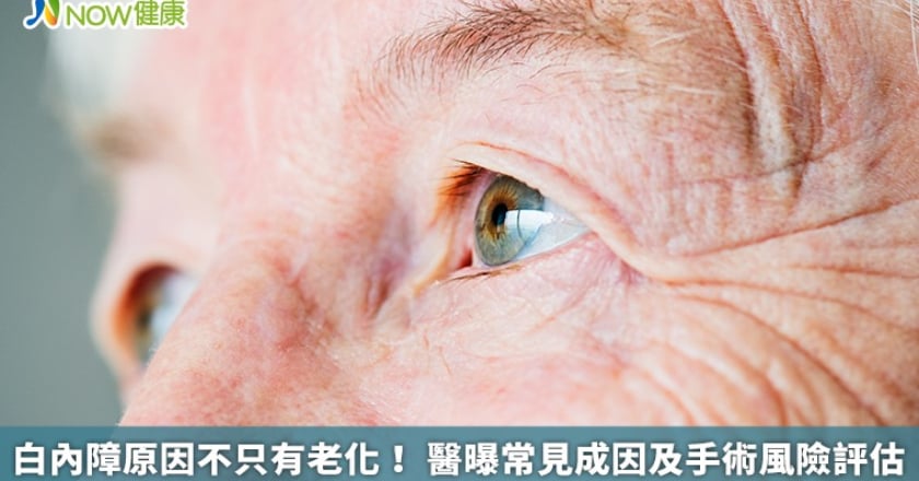 白內障原因不只有老化！ 醫曝常見成因及手術風險評估
