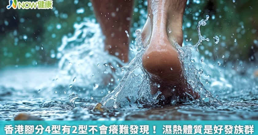 香港腳分4型有2型不會癢難發現！ 濕熱體質是好發族群
