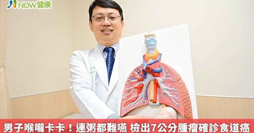男子喉嚨卡卡!連粥都難嚥 檢出7公分腫瘤確診食道癌
