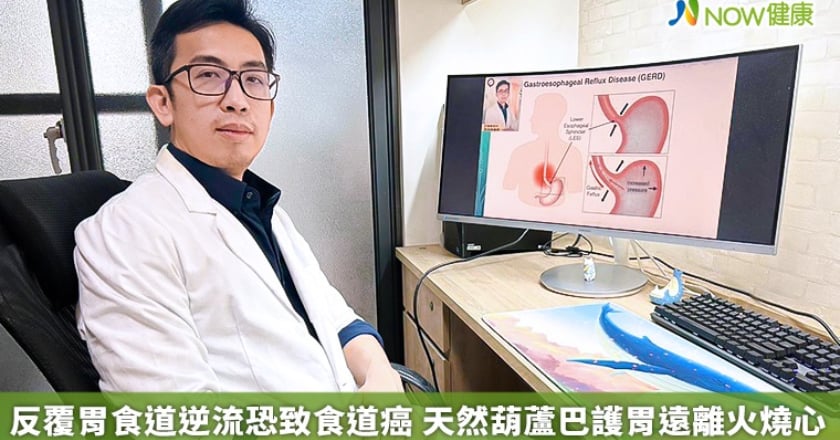 反覆胃食道逆流恐致食道癌 天然葫蘆巴護胃遠離火燒心