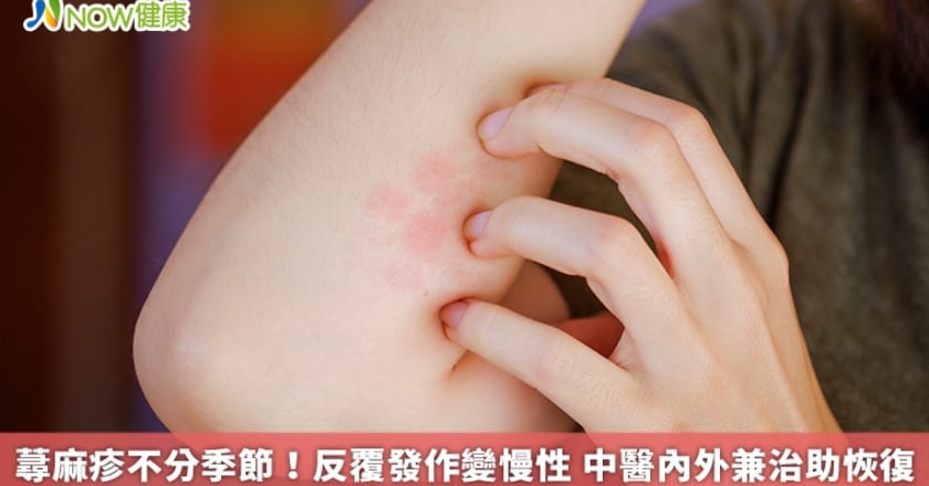 蕁麻疹不分季節!反覆發作變慢性 中醫內外兼治助恢復
