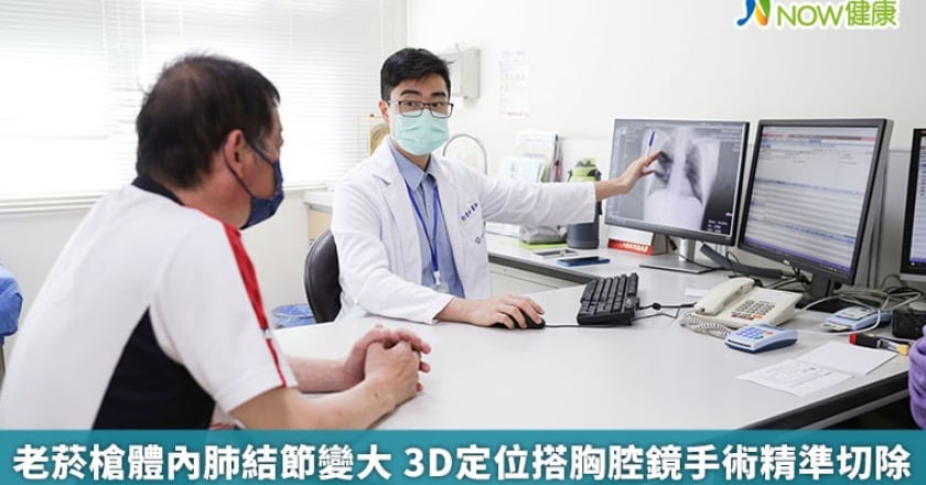 老菸槍體內肺結節變大 3D定位搭胸腔鏡手術精準切除