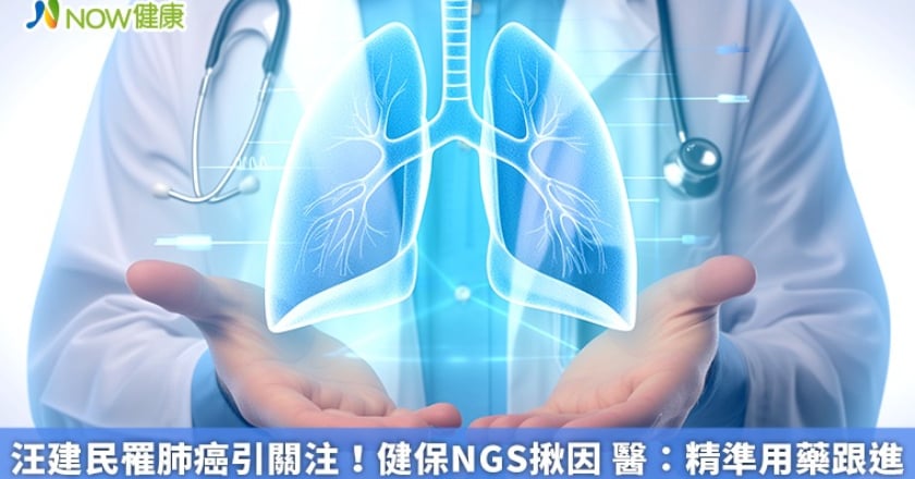 汪建民罹肺癌引關注！健保NGS揪因 醫：精準用藥跟進