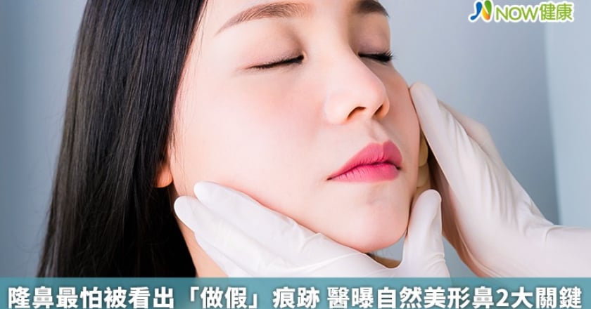 隆鼻最怕被看出「做假」痕跡 醫曝自然美形鼻2大關鍵