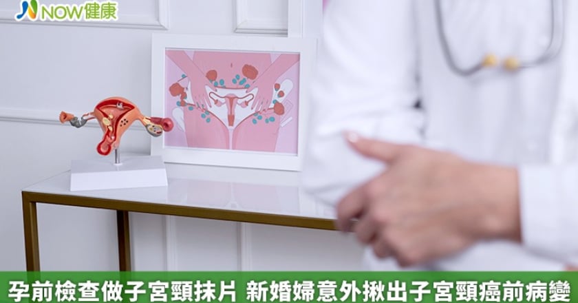 孕前檢查做子宮頸抹片 新婚婦意外揪出子宮頸癌前病變