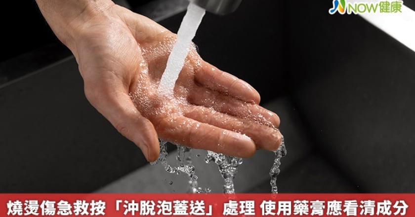 燒燙傷急救按「沖脫泡蓋送」處理 使用藥膏應看清成分