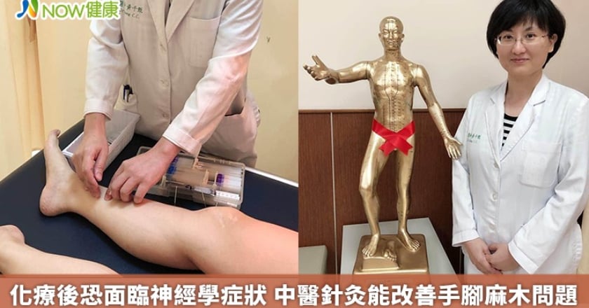 化療後恐面臨神經學症狀 中醫針灸能改善手腳麻木問題