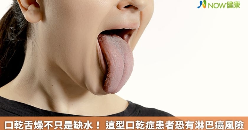口乾舌燥不只是缺水! 這型口乾症患者恐有淋巴癌風險