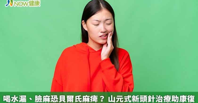 喝水漏、臉麻恐貝爾氏麻痺？ 山元式新頭針治療助康復