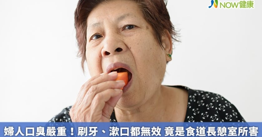 婦人口臭嚴重!刷牙、漱口都無效 竟是食道長憩室所害