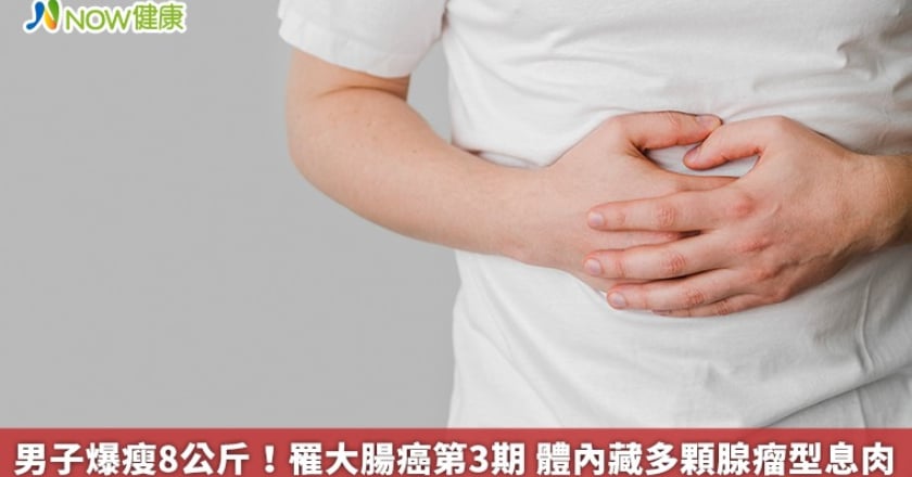 男子爆瘦8公斤！罹大腸癌第3期 體內藏多顆腺瘤型息肉