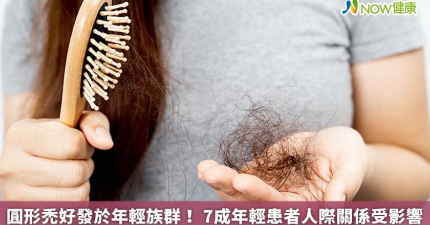 圓形禿好發於年輕族群！ 7成年輕患者人際關係受影響
