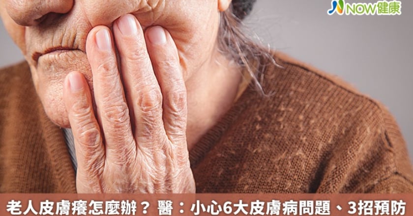 老人皮膚癢怎麼辦？ 醫：小心6大皮膚病問題、3招預防