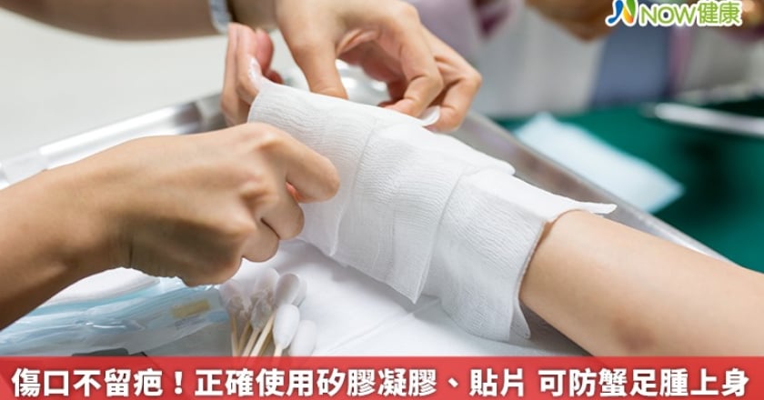 傷口不留疤!正確使用矽膠凝膠、貼片 可防蟹足腫上身