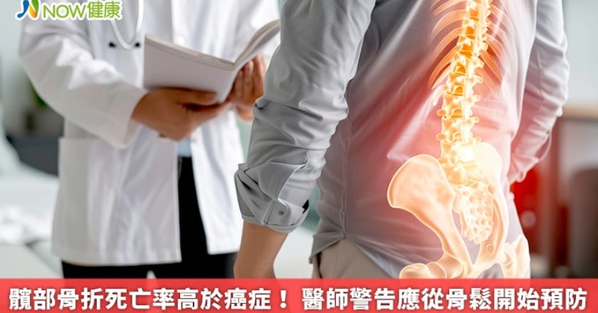 髖部骨折死亡率高於癌症! 醫師警告應從骨鬆開始預防