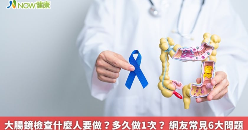 大腸鏡檢查什麼人要做？多久做1次？ 網友常見6大問題