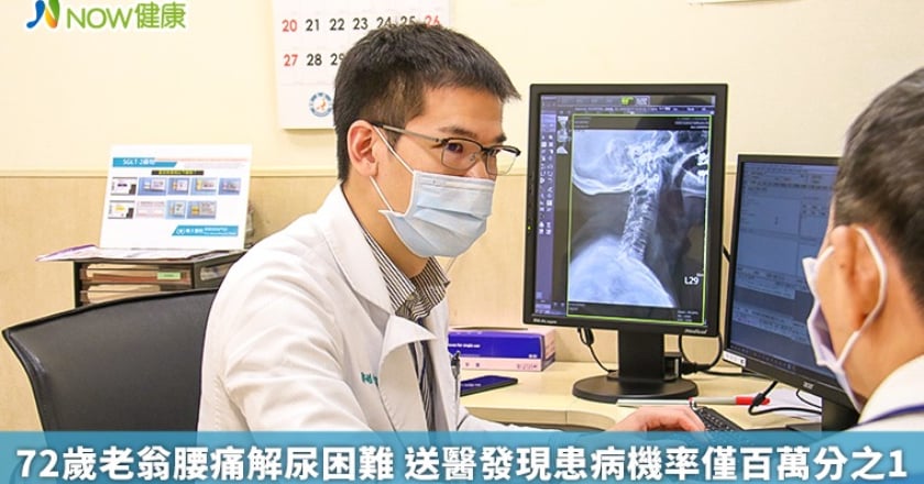 72歲老翁腰痛解尿困難 送醫發現患病機率僅百萬分之1