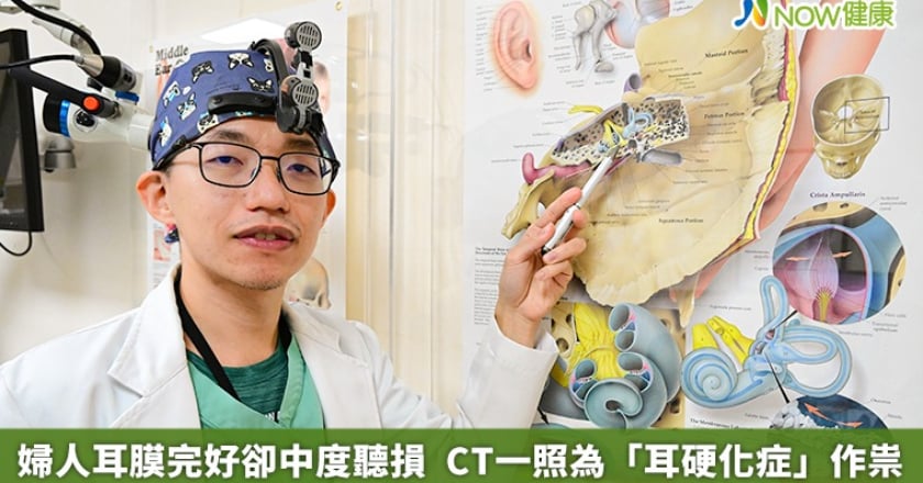 婦人耳膜完好卻中度聽損 CT一照為「耳硬化症」作祟