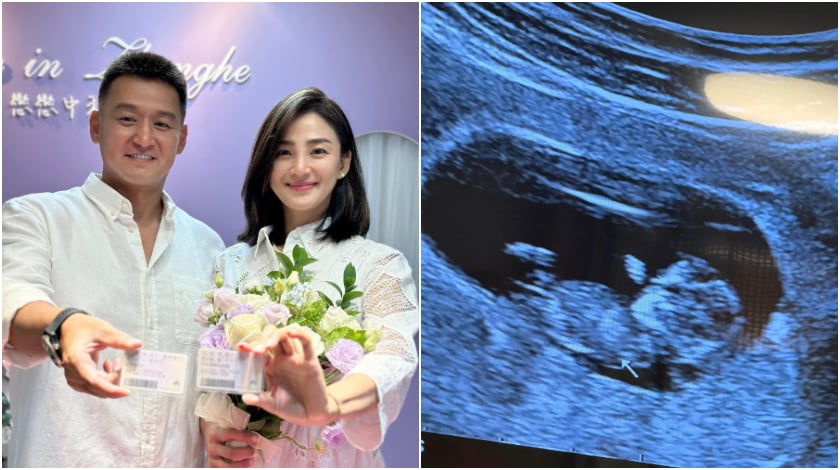 洪小鈴張天霖登記結婚 雙喜臨門曬超音波照報喜