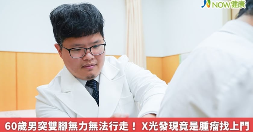 60歲男突雙腳無力無法行走！ X光發現竟是腫瘤找上門
