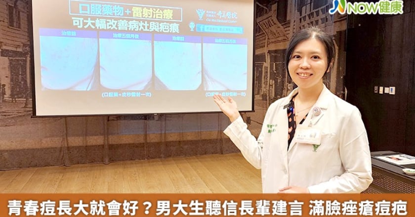 青春痘長大就會好？男大生聽信長輩建言 滿臉痤瘡痘疤