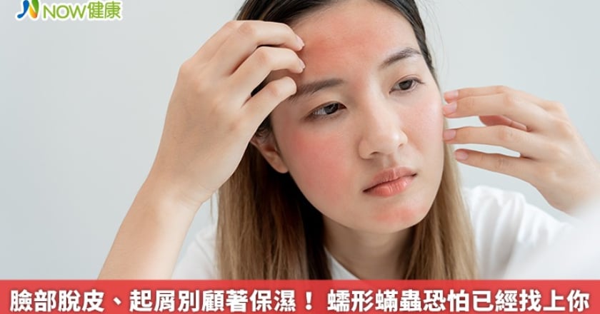 臉部脫皮、起屑別顧著保濕! 蠕形蟎蟲恐怕已經找上你