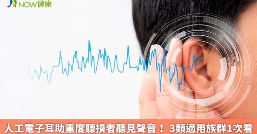 人工電子耳助重度聽損者聽見聲音! 3類適用族群1次看