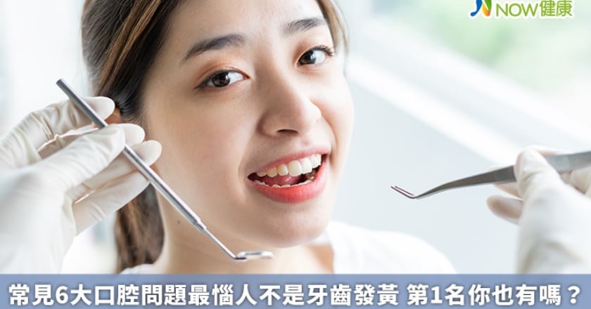 常見6大口腔問題最惱人不是牙齒發黃 第1名你也有嗎？