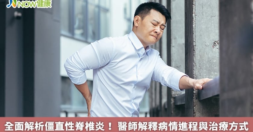 全面解析僵直性脊椎炎！ 醫師解釋病情進程與治療方式
