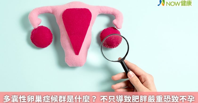 多囊性卵巢症候群是什麼？ 不只導致肥胖嚴重恐致不孕