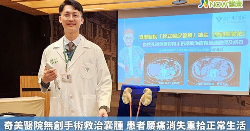 奇美醫院無創手術救治囊腫 患者腰痛消失重拾正常生活