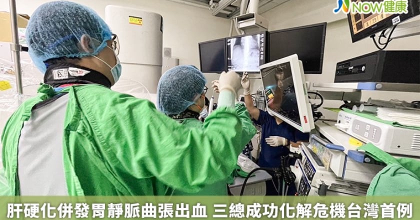 肝硬化併發胃靜脈曲張出血 三總成功化解危機台灣首例